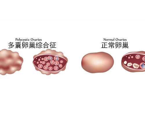 囊胚6bc等级好不好？~专业代生助孕