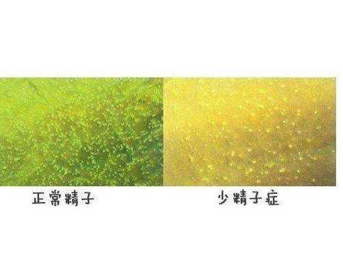 精卵质量差怎么保障试管婴儿成功率?