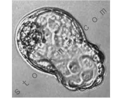 宁夏幼稚子宫做试管婴儿权威医院名单,附2026三代试管生男孩条件一览