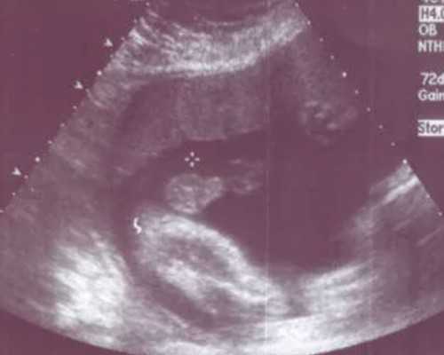 2026年芜湖做试管婴儿比较好的医院是哪家,弋矶山医院做试管怎么样?