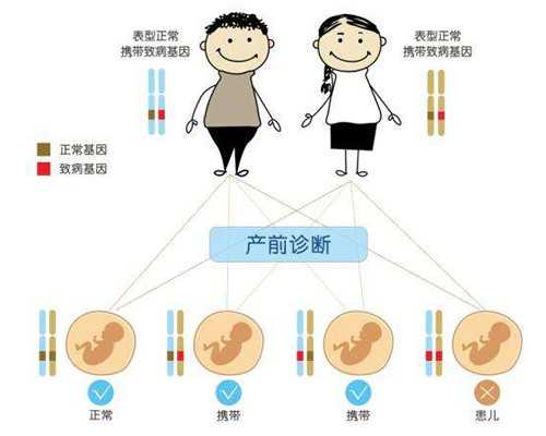 男性在赴泰做试管婴儿时期有哪些注意事项？