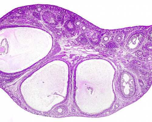 胎心率低于140是男孩还是女孩 胎心率判断生男生女准吗