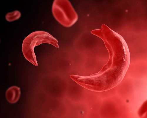 苏州诚信供卵-苏州合法助孕-苏州咨询代孕专家