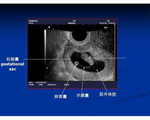 孩子层次不同，跟妈妈打扮有关系