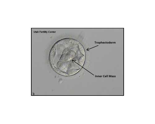 做试管婴儿检查可用卵子少怎么回事,该怎么办