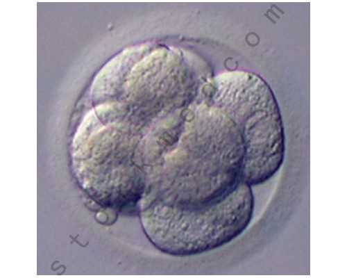 吃调宫寒的中药拉肚子~助孕代生男孩