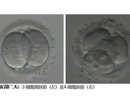 2026年泰州试管婴儿价格多少？试管婴儿有什么弊端吗？