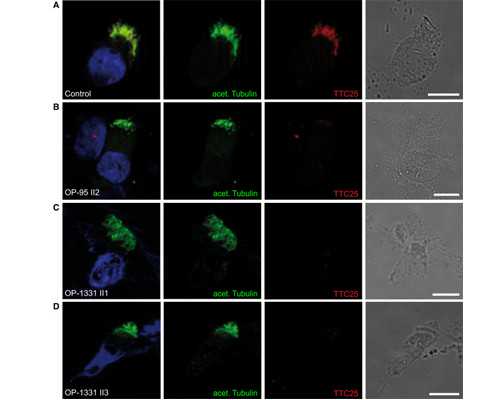 试管婴儿更容易得癌症?谣言止于智者