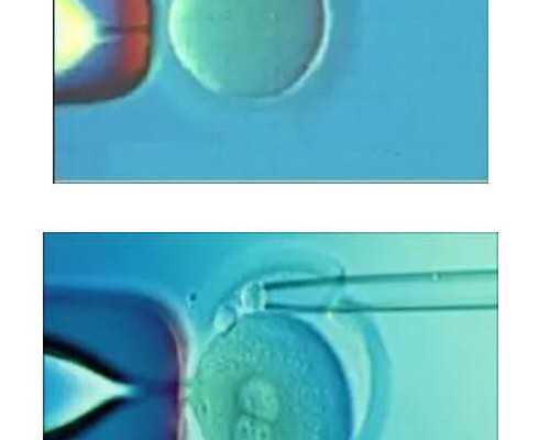 怀孕期间10种常见的身体变化~借卵试管供卵