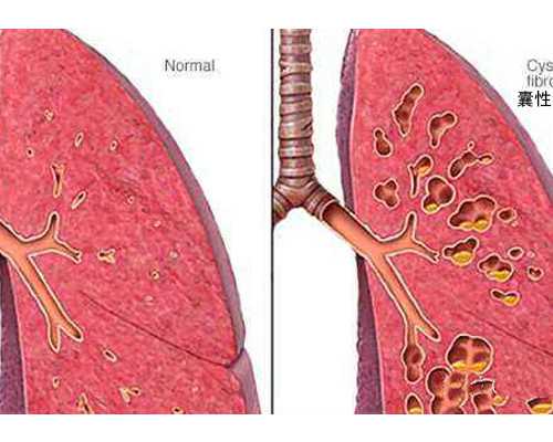 宫寒吃中药拉肚子是怎么回事~医院代生