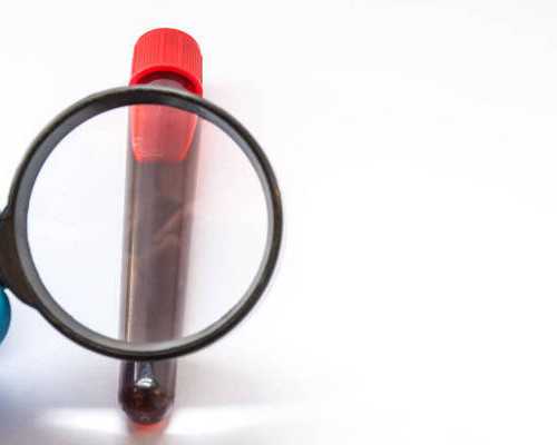 去泰国做试管婴儿可以从睾丸取精吗？