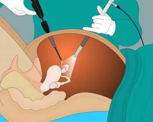 黑龙江弓形子宫做试管婴儿权威医院，附2026三代试管生男孩费用清单