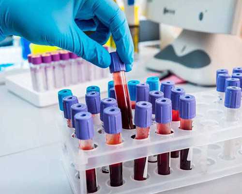 女性怀孕多久可以申请生育险