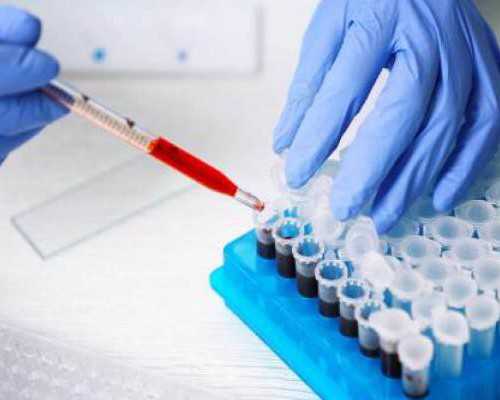 第三代试管婴儿技术,PGS、PGD及NGS讲解,安整版