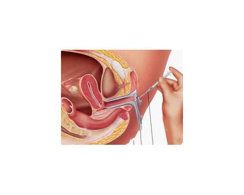2026年苏州三代试管哪个医院好？