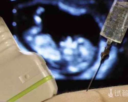 为开始美国试管婴儿打造舒适环境