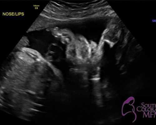 姐妹们在哪做试管？合作市当地能做试管婴儿吗？