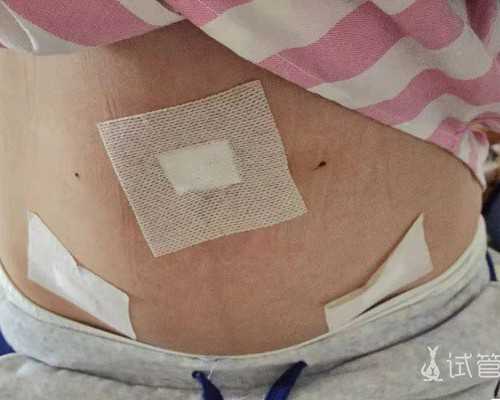 身体发育迟缓第三代试管婴儿