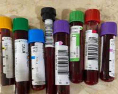 做试管婴儿千万注意预防过渡用药