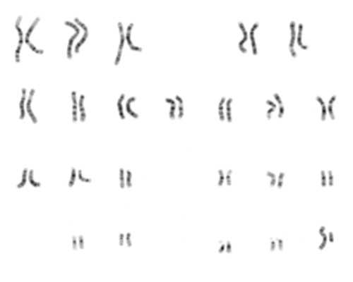 吃了紧急避孕药怀孕了孩子能要吗