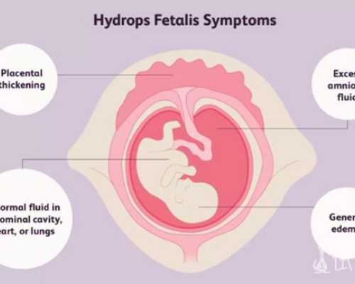 苏州代妈网-苏州代孕户口-苏州助孕应该合法