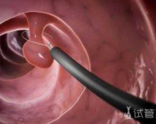 江苏试管婴儿做一次多少钱