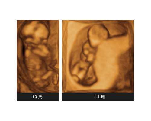 哪些因素在影响苏州人的生育意愿？,苏州试管婴儿成功率受哪些因素影响