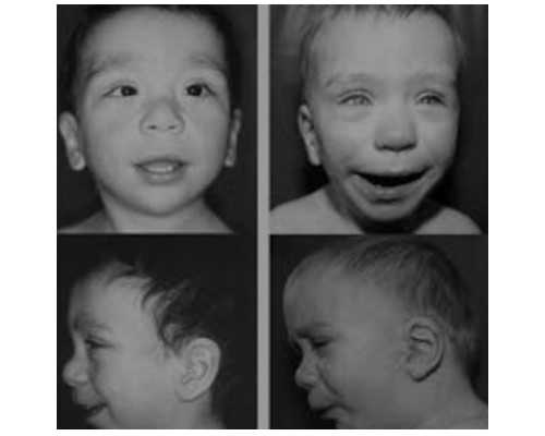 河北试管婴儿多少钱 包含哪些费用