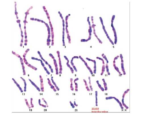 苏州借卵子生小孩 2026苏州市立医院供卵试管婴儿费用： ‘孕晚期三维彩超数据