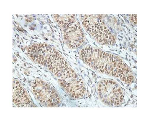 移植冻胚几天着床