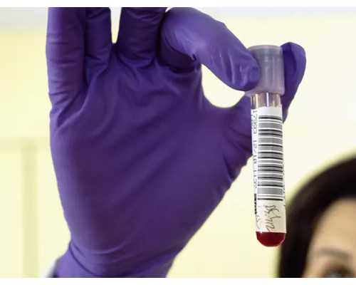 苏州卖卵子_香港验血机构推荐