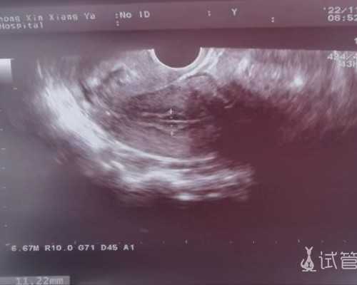 苏州供卵代怀费用表 苏州做试管婴儿费用大约多少？哪家医院成功率更高？ ‘