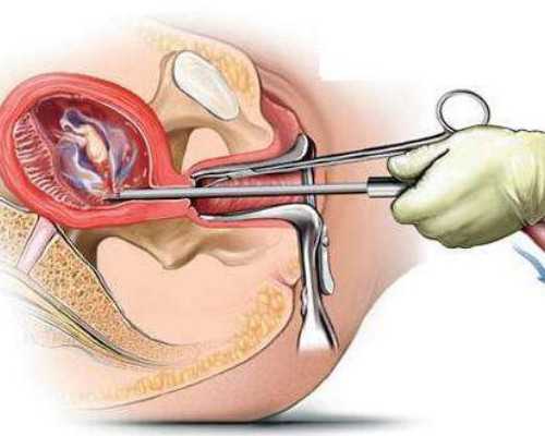 江苏省人民医院试管费用明细！在江苏做三代试管多少钱