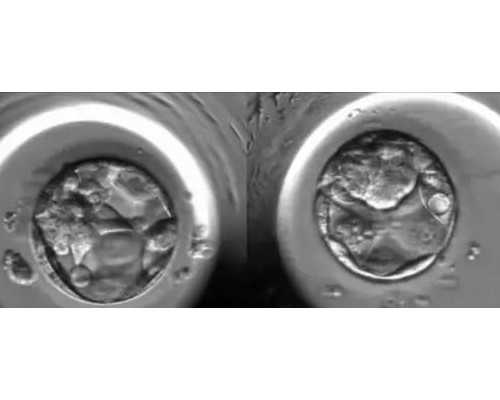 试管婴儿自然周期与促排卵哪个更好？