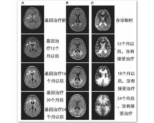 如果你的脸上长斑，你要小心妇科病