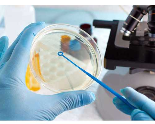 注意，做尿酸碱度检查可以查出这些病