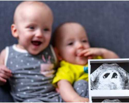 注意了，这几类人更容易得尿毒症