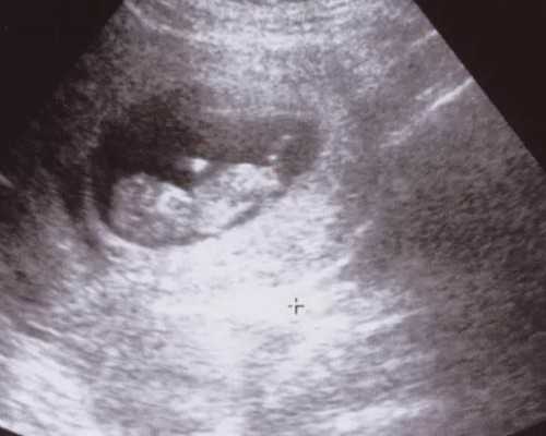 苏州的正规试管婴儿医院收费标准是怎么样的！苏州试管婴儿费用大约多少！