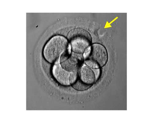 黄体酮肿块最快消除方法分享，怎么防止肿块一看就懂