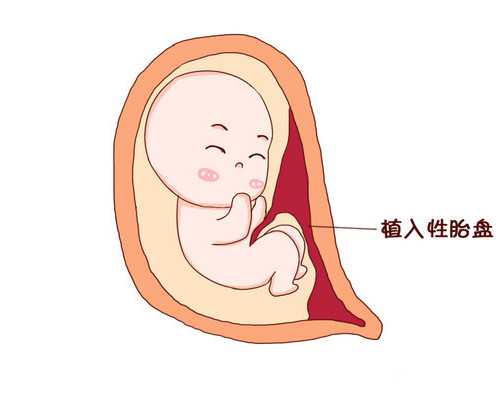 苏州供卵代怀流程 苏州附一院试管婴儿成功率了解这些影响因素很重要 ‘胎囊